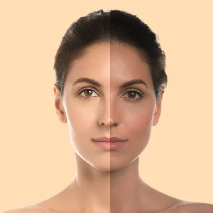 Skin services